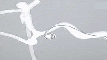 3D 혈관 시뮬레이터 및 투시 조영술 X-ray 사진4